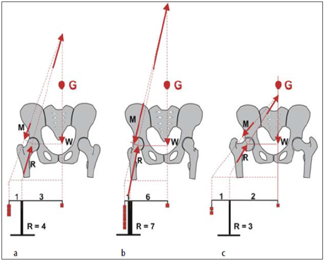 Click here to view Large Figure 14 biomedres-openaccess-journal-bjstr