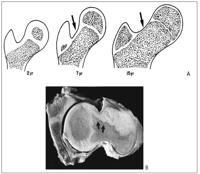 Click here to view Large Figure 2 biomedres-openaccess-journal-bjstr
