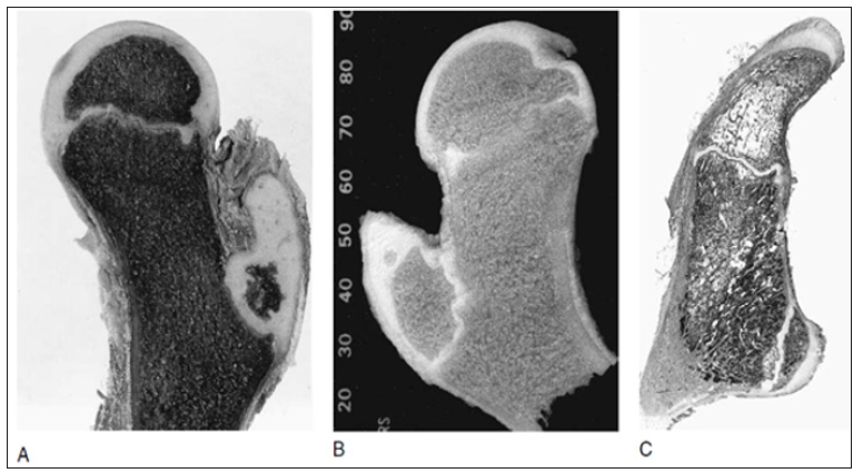 Click here to view Large Figure 3 biomedres-openaccess-journal-bjstr