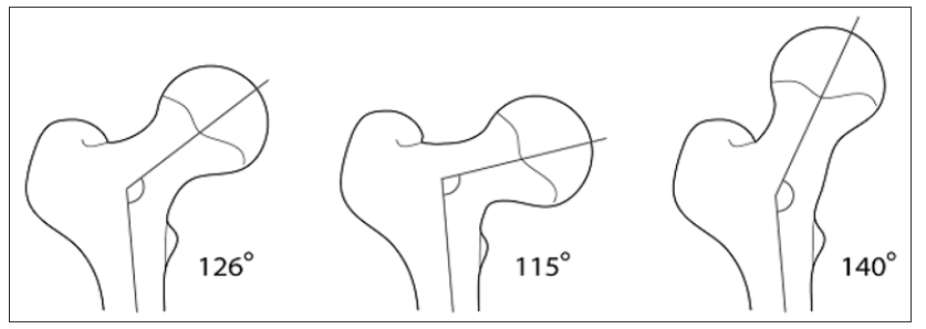 Click here to view Large Figure 5 biomedres-openaccess-journal-bjstr