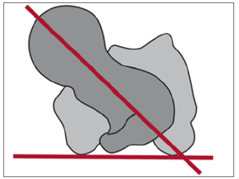 Click here to view Large Figure 7 biomedres-openaccess-journal-bjstr
