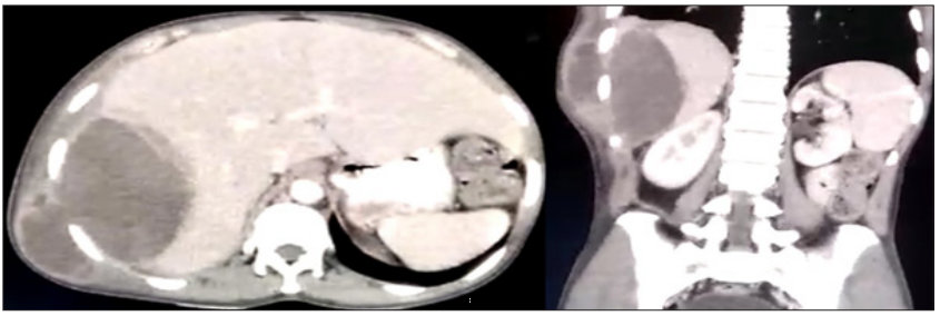 Click here to view Large Figure 1 biomedres-openaccess-journal-bjstr