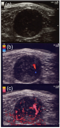 Click here to view Large Figure 1 biomedres-openaccess-journal-bjstr