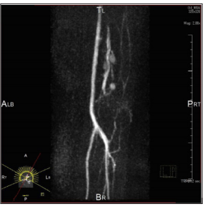 Click here to view Large Figure 4 biomedres-openaccess-journal-bjstr