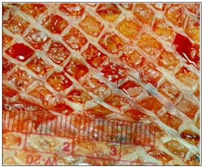 Click here to view Large Figure 3 biomedres-openaccess-journal-bjstr