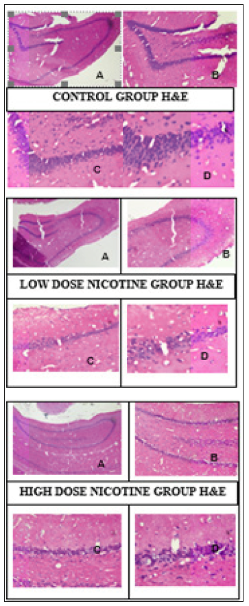 Click here to view Large Figure 1 biomedres-openaccess-journal-bjstr