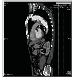 Click here to view Large Figure 1 biomedres-openaccess-journal-bjstr