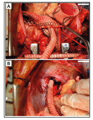 Click here to view Large Figure 3 biomedres-openaccess-journal-bjstr