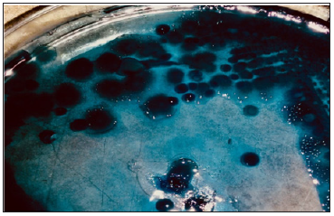 Click here to view Large Figure 1 biomedres-openaccess-journal-bjstr