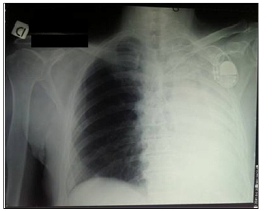 biomedres-openaccess-journal-bjstr