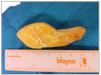 biomedres-openaccess-journal-bjstr