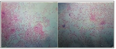 Click here to view Large Figure 6 biomedres-openaccess-journal-bjstr