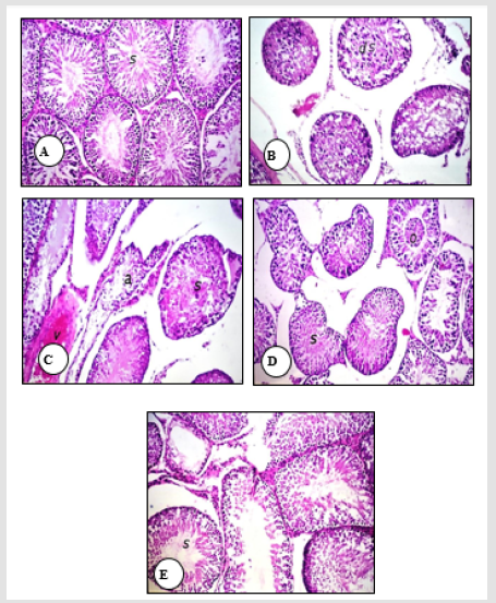 Click here to view Large Figure 1 biomedres-openaccess-journal-bjstr