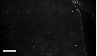 biomedres-openaccess-journal-bjstr