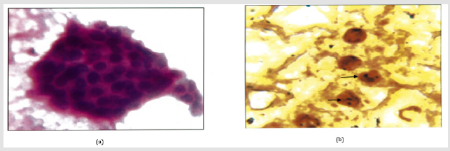Click here to view Large Figure 2 biomedres-openaccess-journal-bjstr