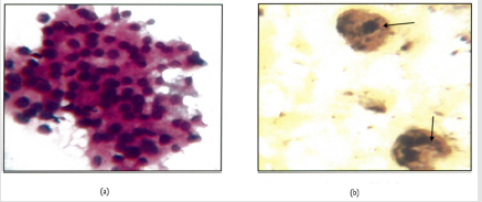 Click here to view Large Figure 3 biomedres-openaccess-journal-bjstr