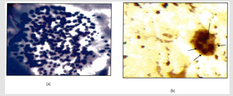 Click here to view Large Figure 5 biomedres-openaccess-journal-bjstr