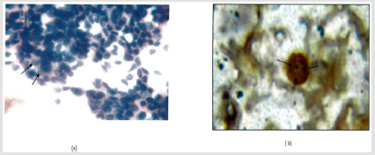 Click here to view Large Figure 6 biomedres-openaccess-journal-bjstr