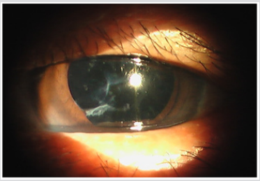 Click here to view Large Figure 1 biomedres-openaccess-journal-bjstr