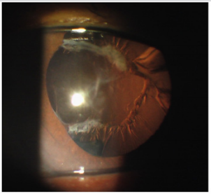 Click here to view Large Figure 2 biomedres-openaccess-journal-bjstr