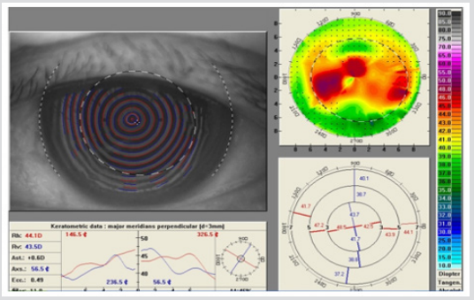 Click here to view Large Figure 3 biomedres-openaccess-journal-bjstr