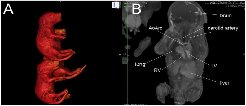 biomedres-openaccess-journal-bjstr