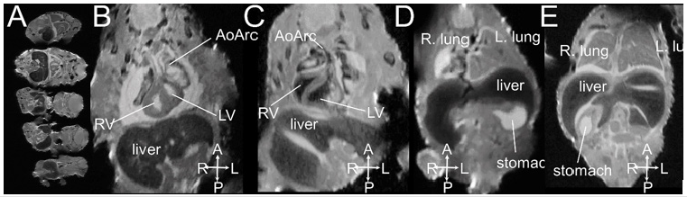 biomedres-openaccess-journal-bjstr
