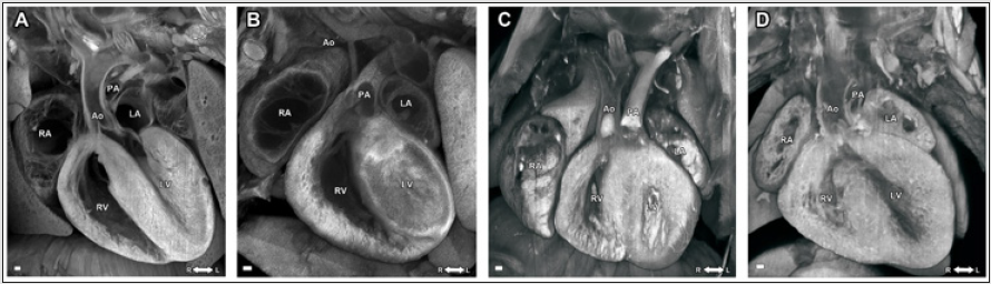 biomedres-openaccess-journal-bjstr