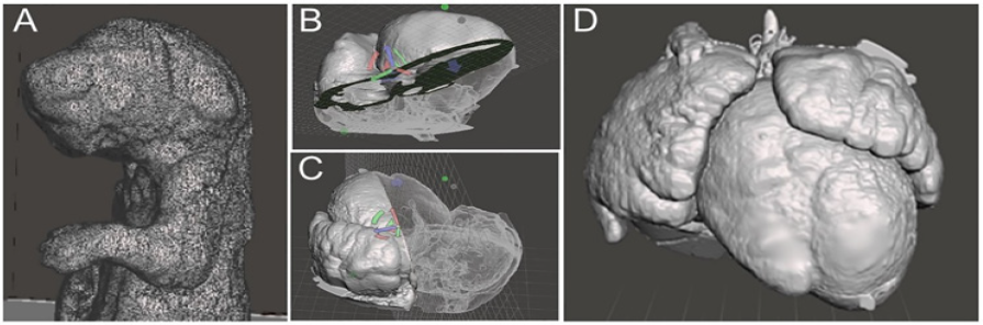 biomedres-openaccess-journal-bjstr