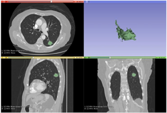 biomedres-openaccess-journal-bjstr