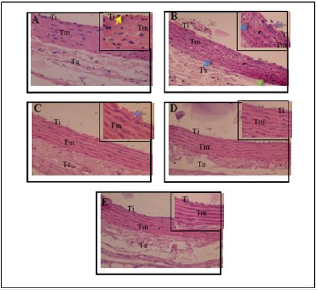 biomedres-openaccess-journal-bjstr
