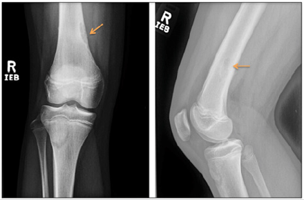 biomedres-openaccess-journal-bjstr
