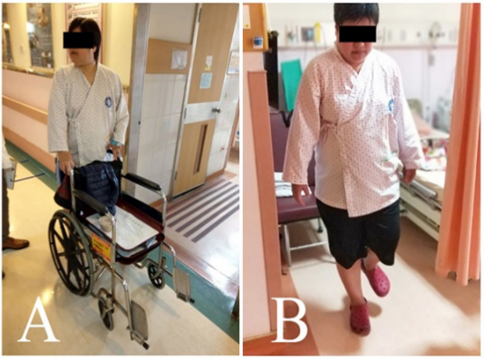 Click here to view Large Figure 1 biomedres-openaccess-journal-bjstr