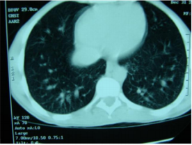 biomedres-openaccess-journal-bjstr