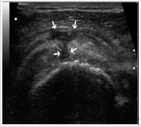 biomedres-openaccess-journal-bjstr