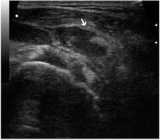 biomedres-openaccess-journal-bjstr