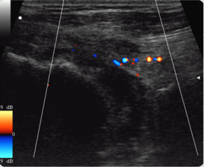 biomedres-openaccess-journal-bjstr