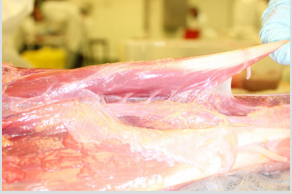 biomedres-openaccess-journal-bjstr