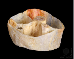 biomedres-openaccess-journal-bjstr