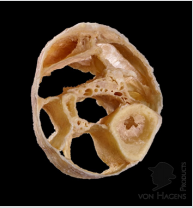 biomedres-openaccess-journal-bjstr