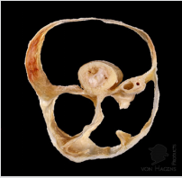 biomedres-openaccess-journal-bjstr