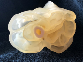 biomedres-openaccess-journal-bjstr