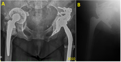 biomedres-openaccess-journal-bjstr