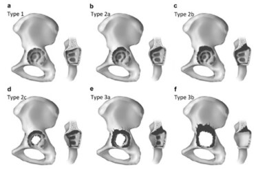 biomedres-openaccess-journal-bjstr