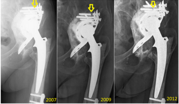 biomedres-openaccess-journal-bjstr