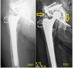 biomedres-openaccess-journal-bjstr