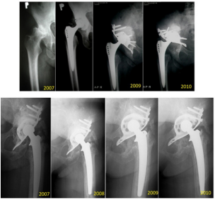 biomedres-openaccess-journal-bjstr
