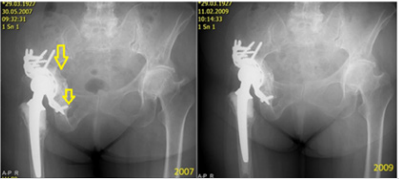 biomedres-openaccess-journal-bjstr