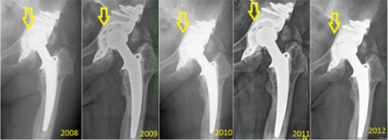 biomedres-openaccess-journal-bjstr