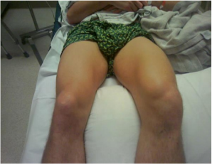 biomedres-openaccess-journal-bjstr